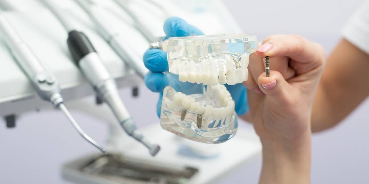 Dental Implants in Lubbock TX