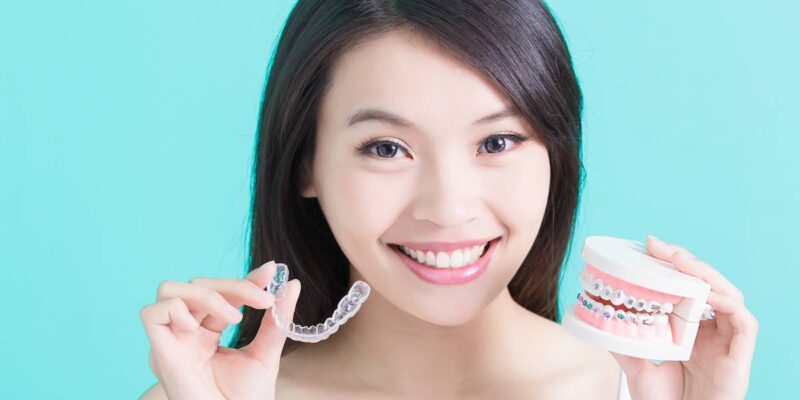 Invisalign Aligners in Lubbock TX