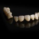 Role Of General And Family Dentistry In Oral Restoration