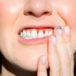 A Detailed Guide to the Top Effective Gum Disease Treatments_FI
