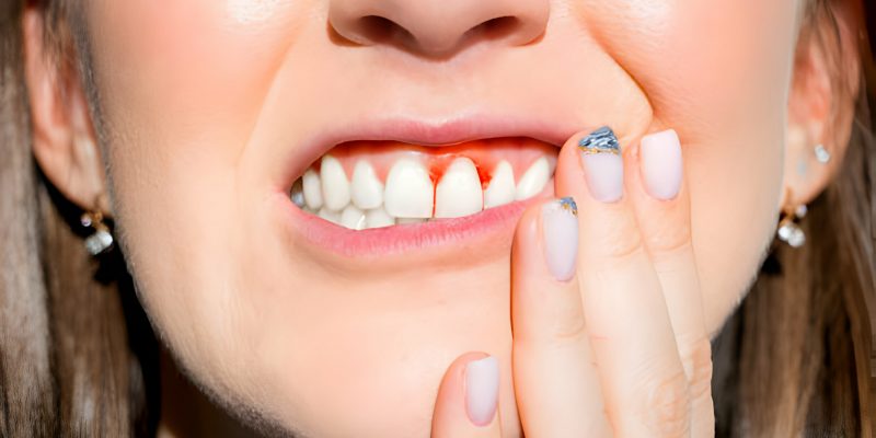 A Detailed Guide to the Top Effective Gum Disease Treatments_FI