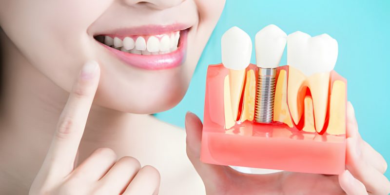 The Impact Of Dental Implants On Your Oral Health_FI