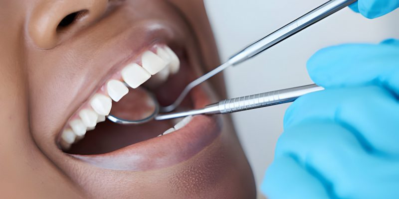 Unlocking the Secrets of Cosmetic Dentistry in Lubbock, Texas_FI