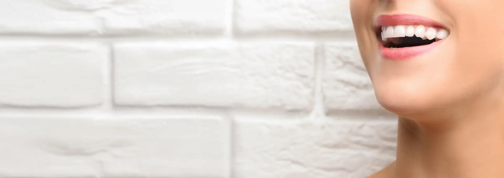 Dental Bonding Banner Image Dental Bonding Banner Image