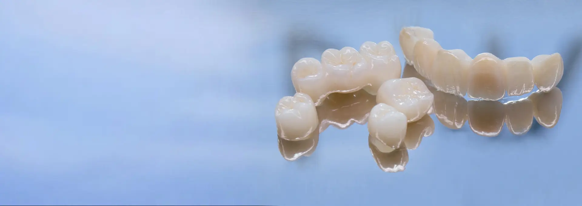 Dental Bridge Banner Image Dental Bridge Banner Image