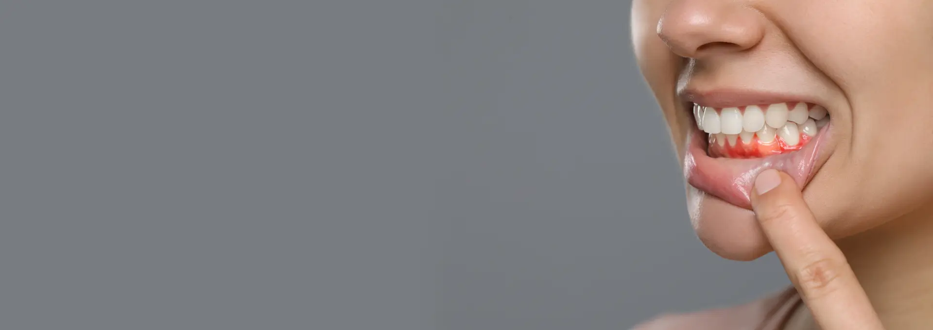 Gum Disease Treatment Banner Image Gum Disease Treatment Banner Image