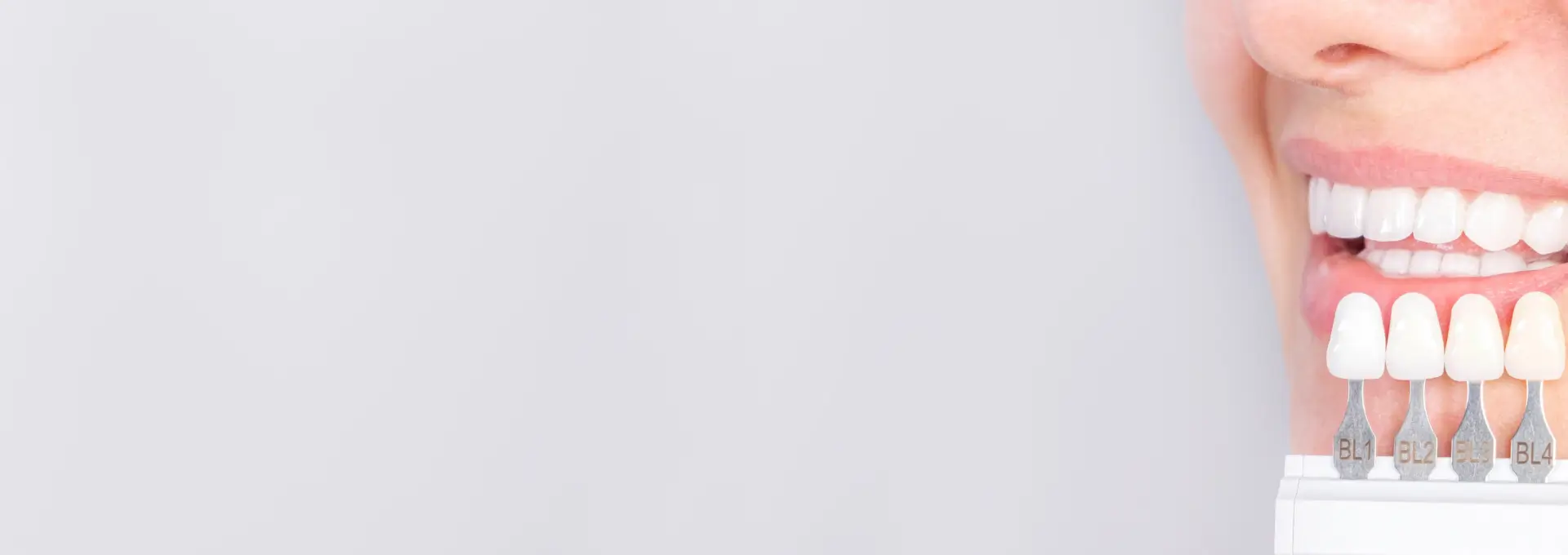 Porcelain Veneers Banner Image