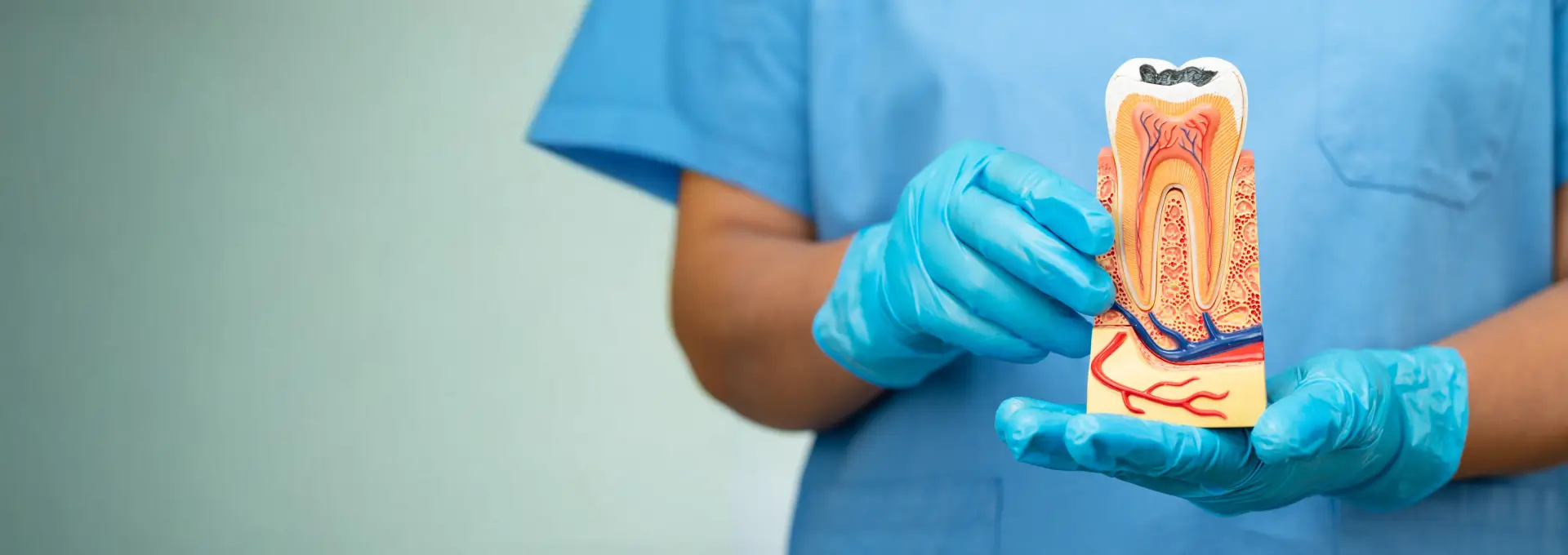 Root Canal Treatment Root Canal Treatment