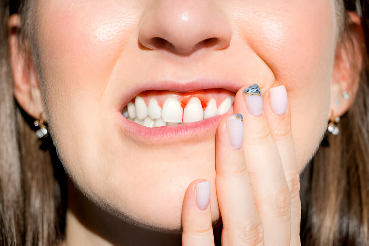 Why Early Gum Disease Treatment Matters - Lubbock Dental Insights_FI
